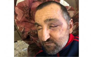 شهادة السيد الكفيف منذر طلال مزهر حول اعتداء قوات الاحتلال عليه وضربه بشكل مبرح في بيته رغم خطورة حالته الصحية