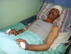 Palestinian Shepherd Beaten with Metal Rods by Settlers