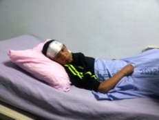 13-year Old Palestinian Shot in the Face with Rubber Bullet