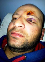 injury-abood-natsheh