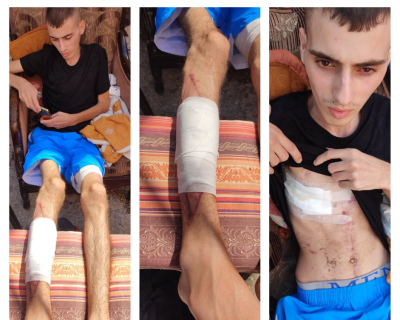 Special Focus: Use of Excessive Force by the Israeli Occupying Forces, the Case of Abdallah Abu Baker