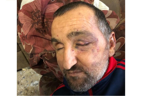 شهادة السيد الكفيف منذر طلال مزهر حول اعتداء قوات الاحتلال عليه وضربه بشكل مبرح في بيته رغم خطورة حالته الصحية